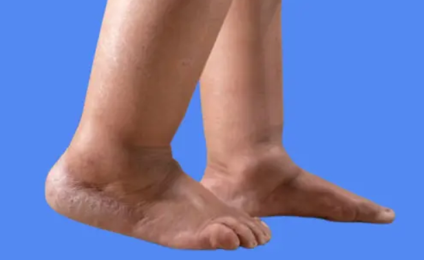 le drainage lymphatique pour les jambes gonflées et la rétention d'eau