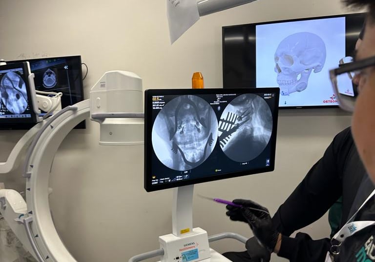 Dr Gilnard opera Trauma Cranioencefálico e da coluna em Fortaleza Ceará