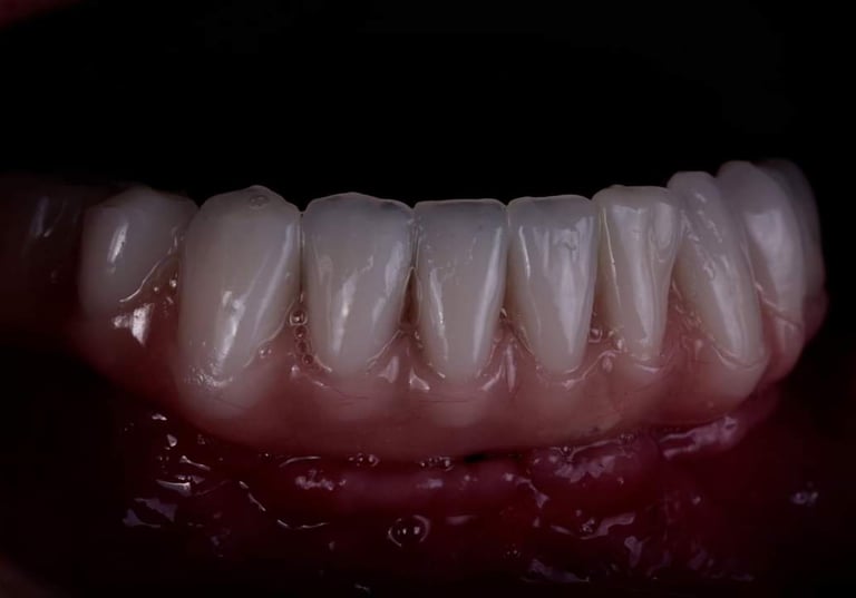 Prótese implantes cerâmica zirconia