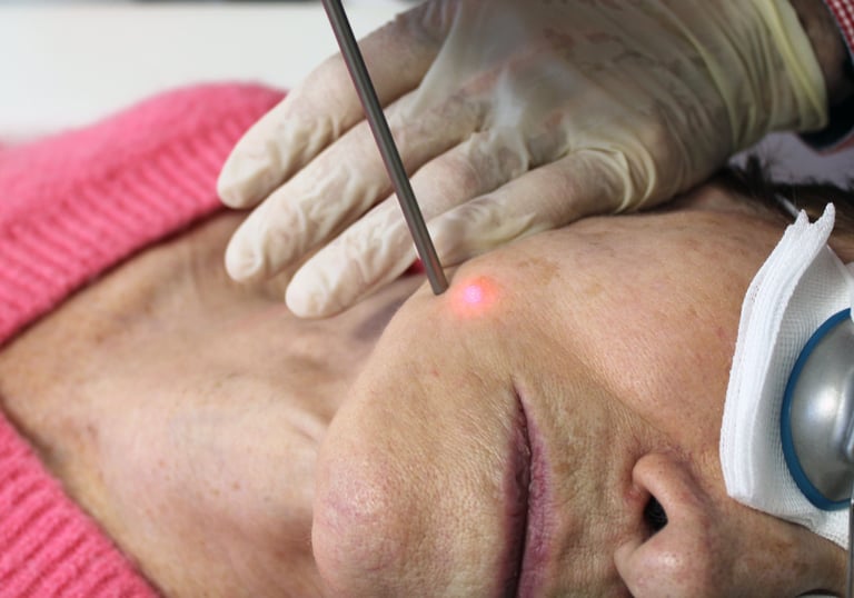 cabinet perma medical : mélasma et tâches pigmentaires