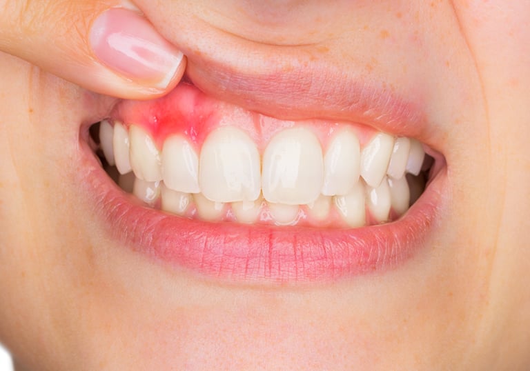 healthy dental gum or gingiva care
