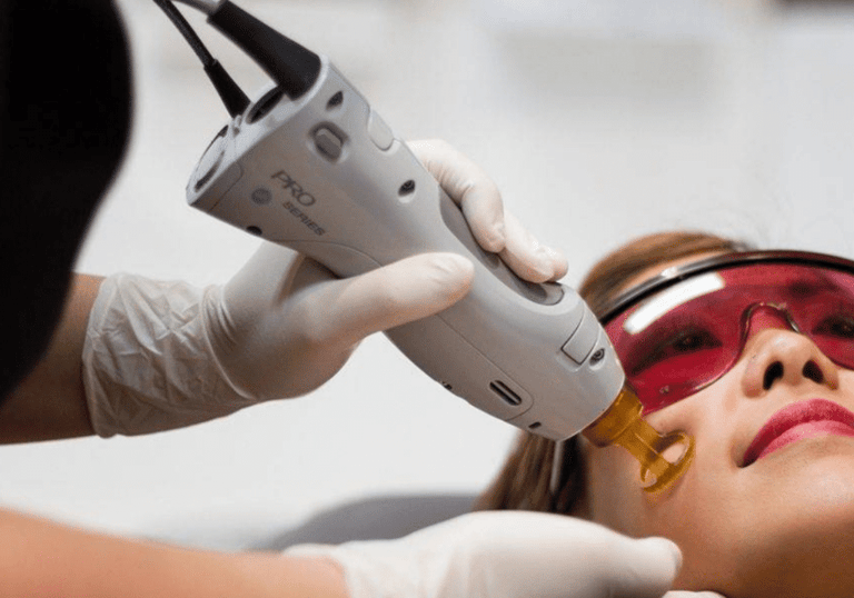 Laser Skin Treatments