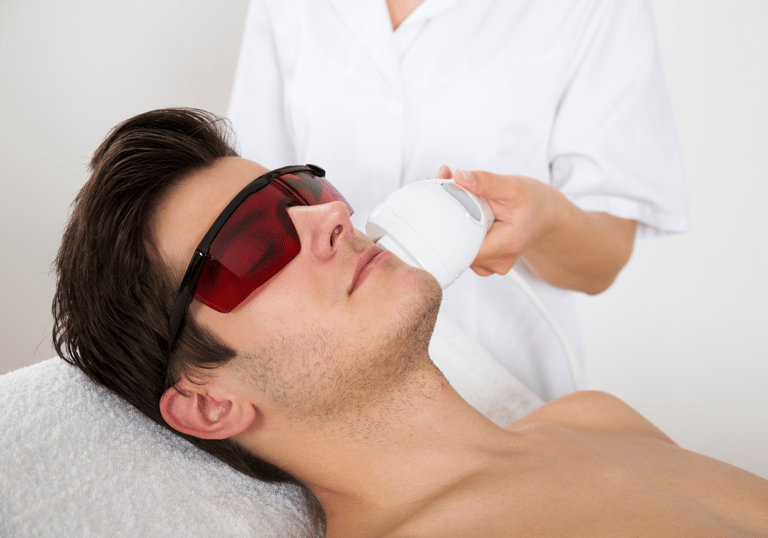 homre recibiendo un tratamiento de depilacion laser tridiodo