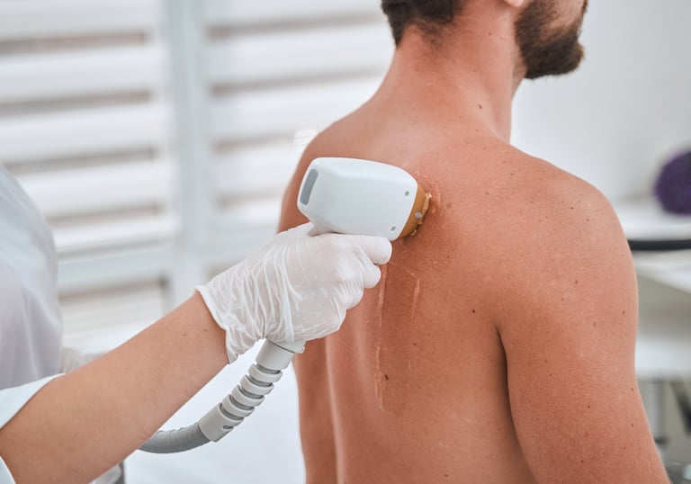 hombre en sesion de depilacion laser