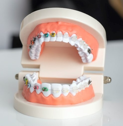 Dentist In Rockwall put smiles on people.