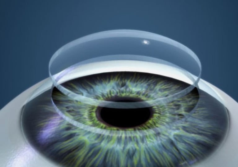 Trasplante de Córnea de Adultos y Niños en Guayaquil