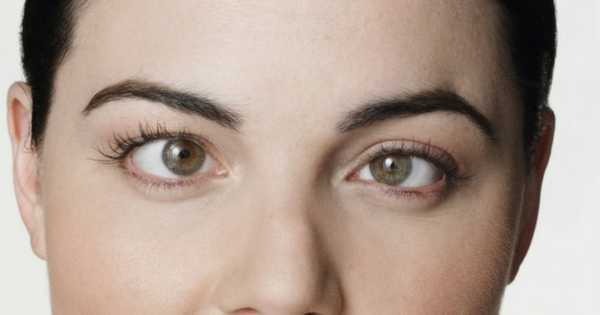 Tratamiento del Estrabismo en Guayaquil