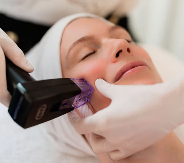 Morpheus 8 facial en Keauty Studio Narvarte.