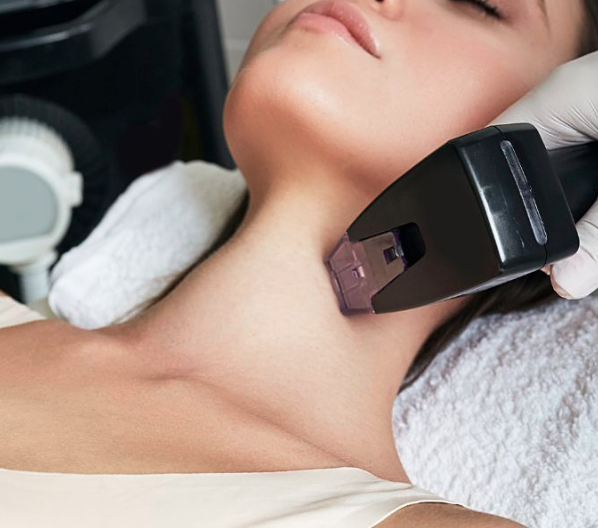 Morpheus 8 en cuello CDMX.