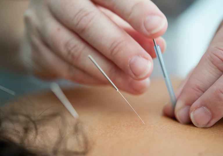 Wednesfield Acupuncture Clinic
