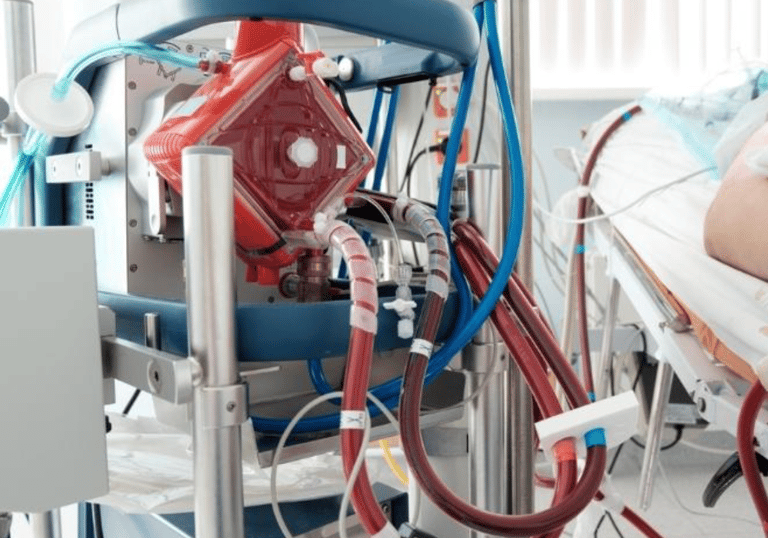 ECMO
