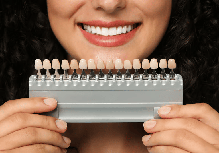 Paciente comparando a cor dos dentes para tratamento de lentes de contato com dentista em Palmas na Goen