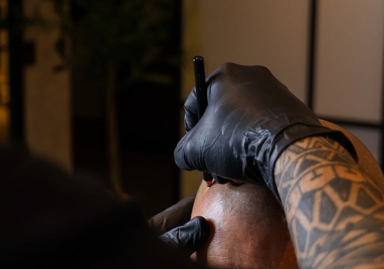 micropigmentation capillaire sur quelqu'un qui a une calvitie totale