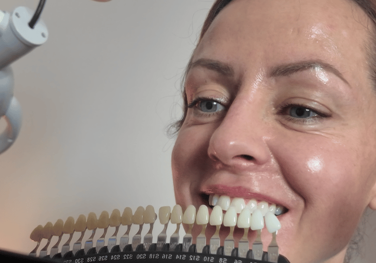 GloSmilz teeth whitening analysis
