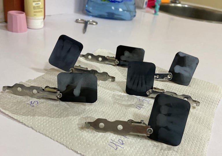 raio x odontológico