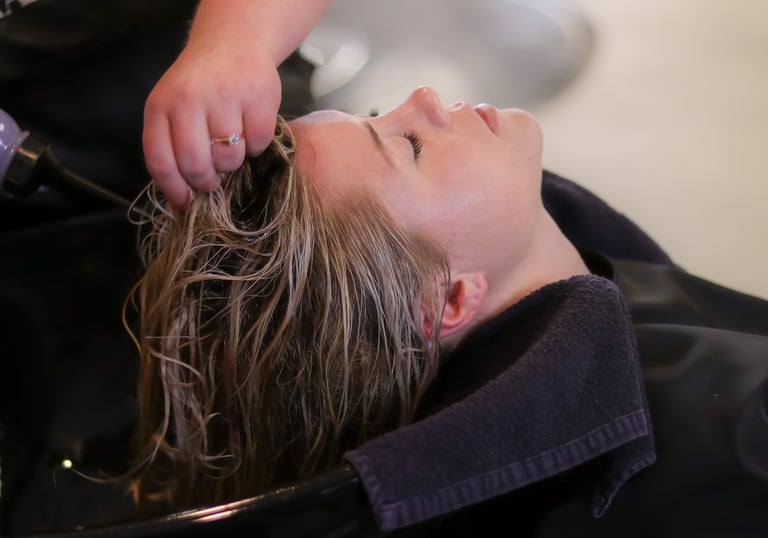 PRP hair restoration treatment in progress at Kandyan Aesthetics Kandy