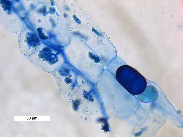 arbuscular m