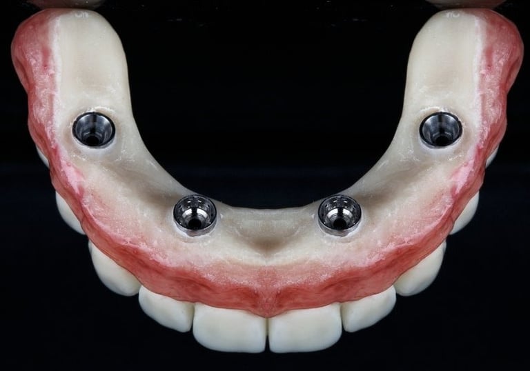 All on 4 zirconia fixed bridge