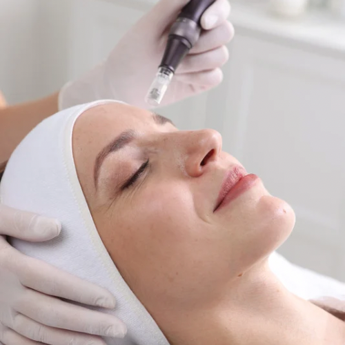 Microneedling in Hertford at Skin Therapy Solutionss 