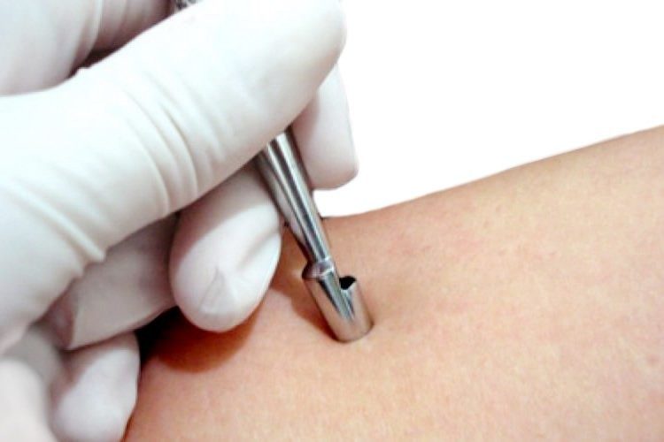 Tratamento_Dermatologico_Centro_Medico_Vida