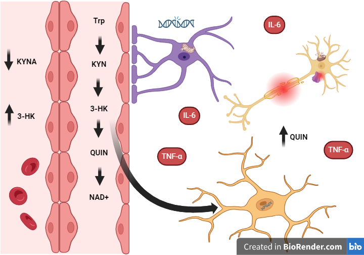 Hipótesis de neurodegeneración en Esclerosis Múltiple Progresiva