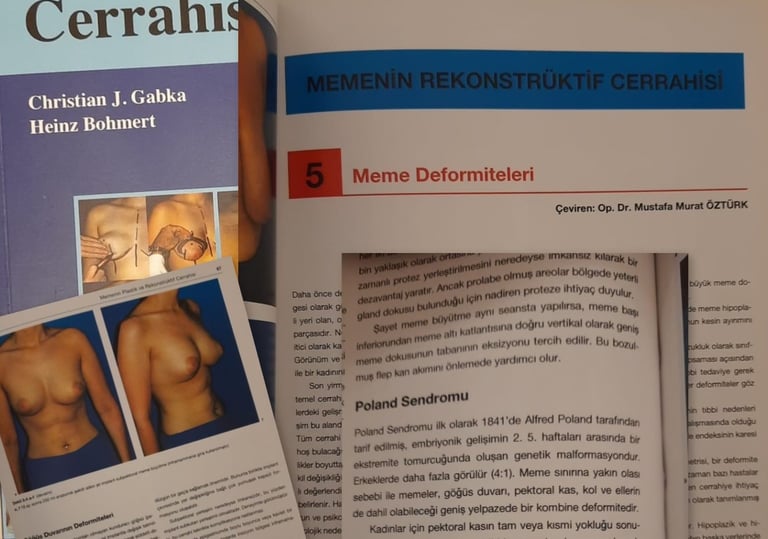 Meme Estetik ve Rekonstrüktif Cerrahi Kitabı, Poland Sendromu, Tübüler meme, Tüberoz meme bölümleri 