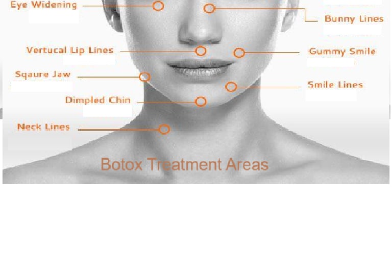Botox treatment areas for wrinkle reduction at Gurugram (Gurgaon) clinic.