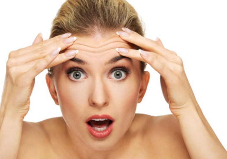 Botox para eliminar arrugas en frente, entrecejo y patas de gallo.
