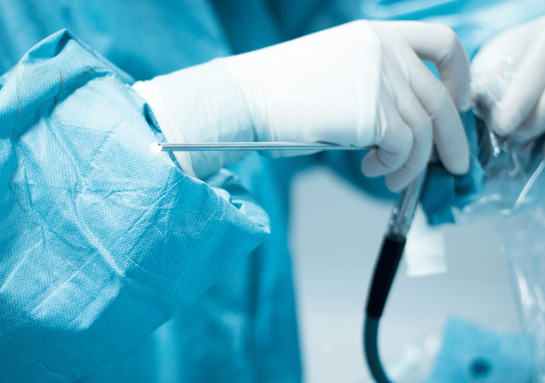 Artroskopinė operacija