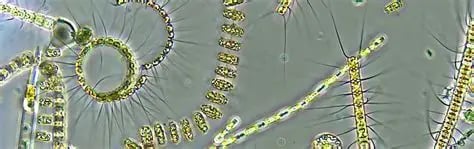 Microscopic view of Chaetoceros marine diatoms and phytoplankton chains in green water.
