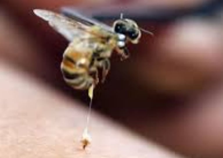 Apitherapy  