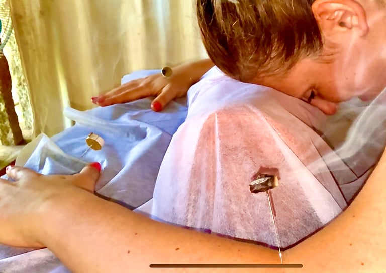 a picture of Alena Booth, founded of Grateful Minds doing acupunture in India