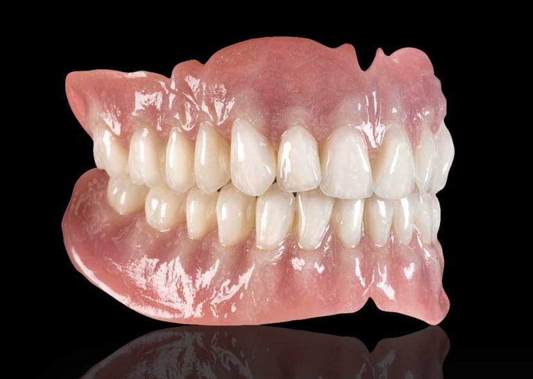 Gigi palsu lepasan di Sidharta Dental Studio Malang, solusi gigi hilang yang nyaman