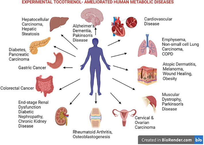 Tocotrienol Ameliarated Human Metabolic Diseases