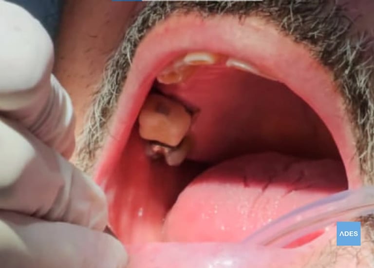 Diagnóstico odontológico en Badajoz