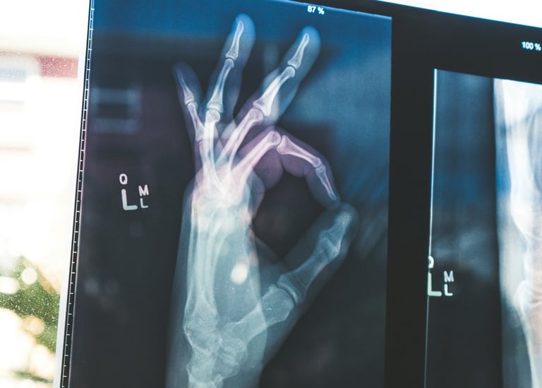 OK hand gesture x-ray