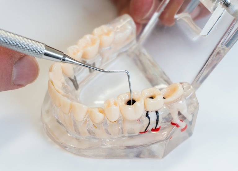 A dental professional uses a metal probe on a transparent anatomical model of human teeth to show cavities.