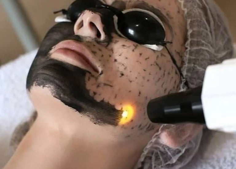 Hollywood Peel