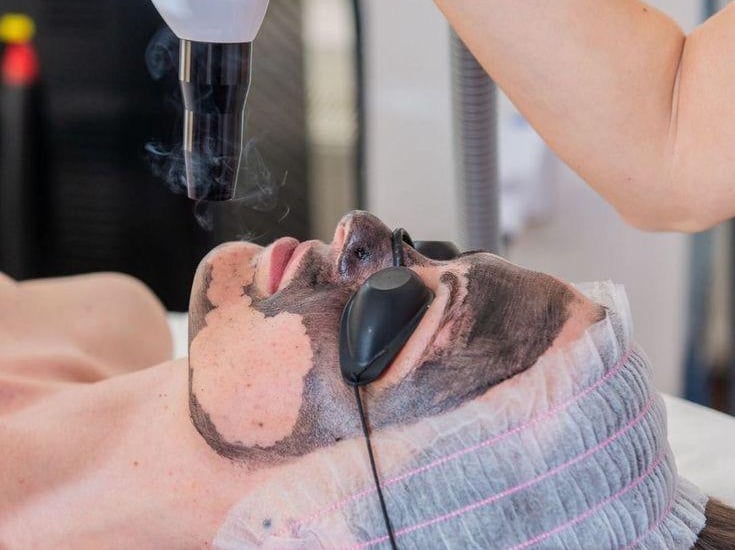 Hollywood Peel