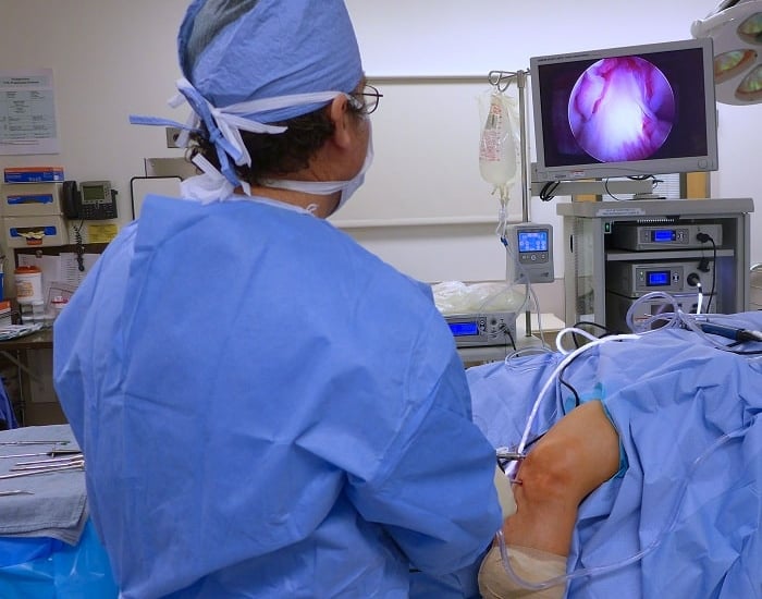 best arthroscopy surgeon in bangalore