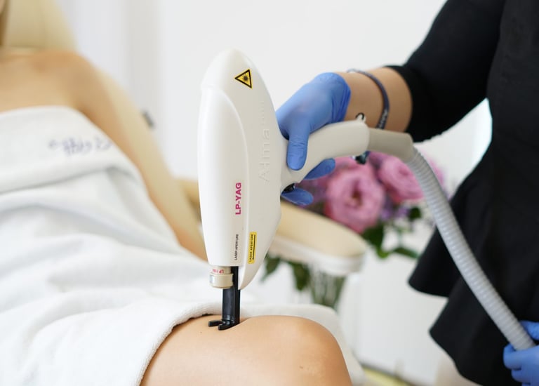 laser vascular para arañitas