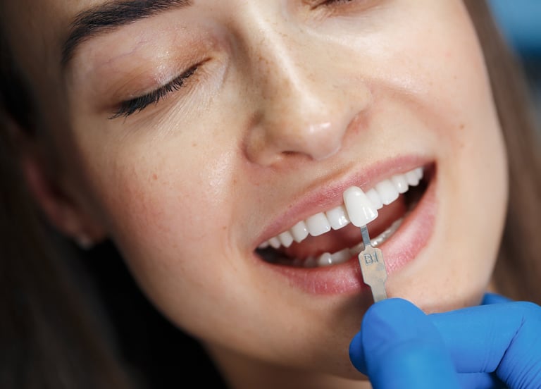Affordable Veneers Navi Mumbai | Ekdantam Dental Clinic