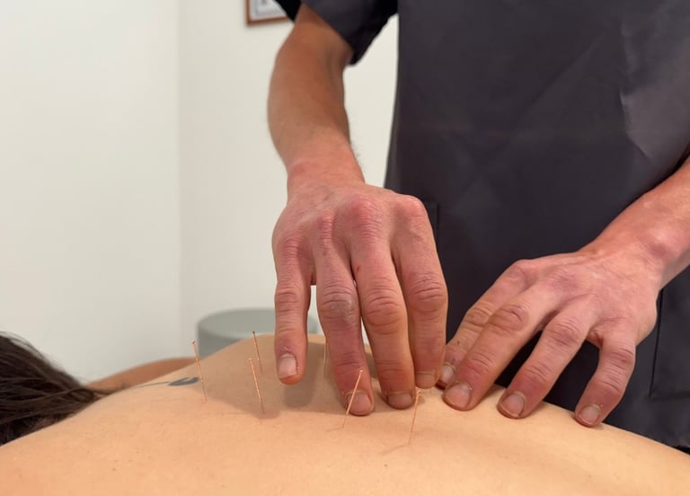 Aurelio_aplicando_tratamiento_de_acupuntura