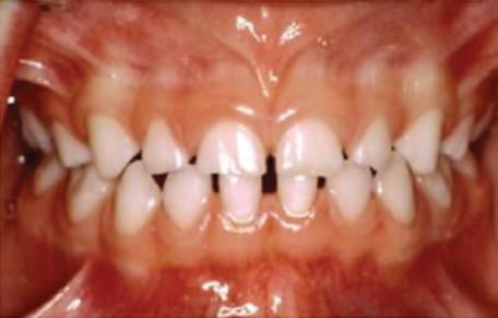 a image showing all teeth in mouth