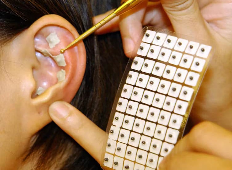 sevrage tabagique nîmes par l'auriculothérapie