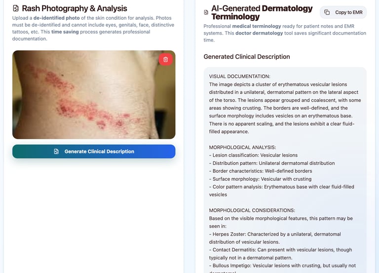 Sample output from dermdescribe app interpreting a shingles rash