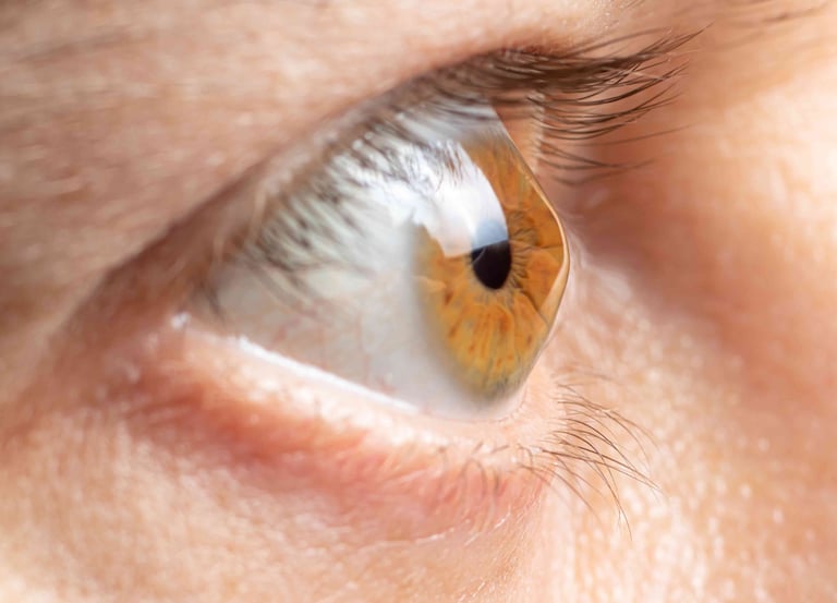 علاج القرنية المخروطية