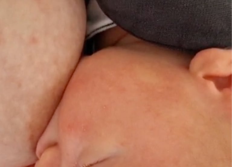 baby breastfeeding after tongue tie division with private midwife anika riesen