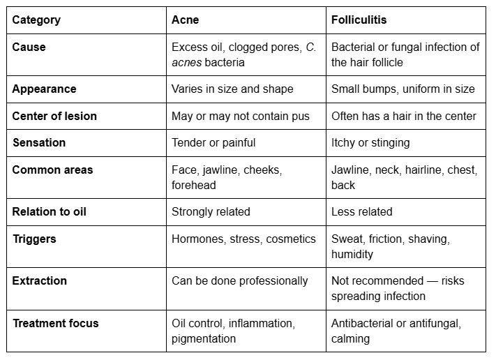 Comparison chart showing differences between acne and folliculitis symptoms, causes, and treatments.