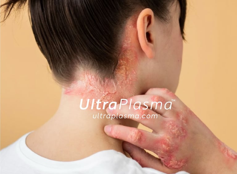 _ultra_plasma_ultra_plazma_ultra-plasma_ultra-plazma